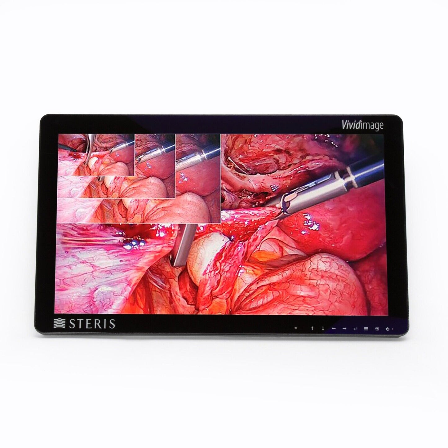 Steris Vividimage 27” HD Color Surgical Display Monitor RLM27HD2 - NO CHARGER