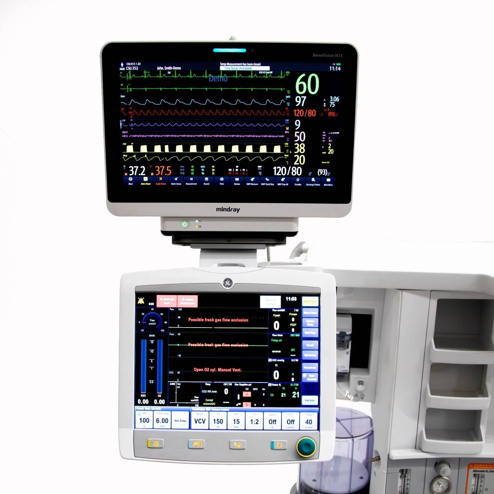 GE Avance CS2 Pro Anesthesia Machine, E-sCAiO Gas Module, Mindray Benevision N15