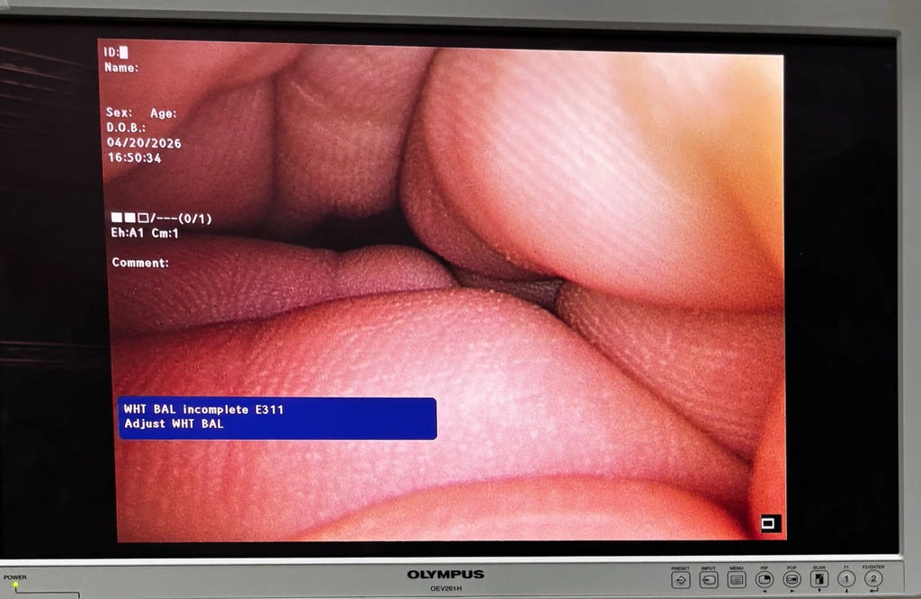 Olympus WA50040A 10.0 mm 0º HD ENDOEYE II Video Laparoscope
