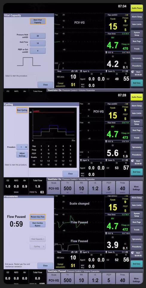 GE Carestation 650 Anesthesia Machine; E-sCAiO Gas Module, Philips IntelliVue MX550